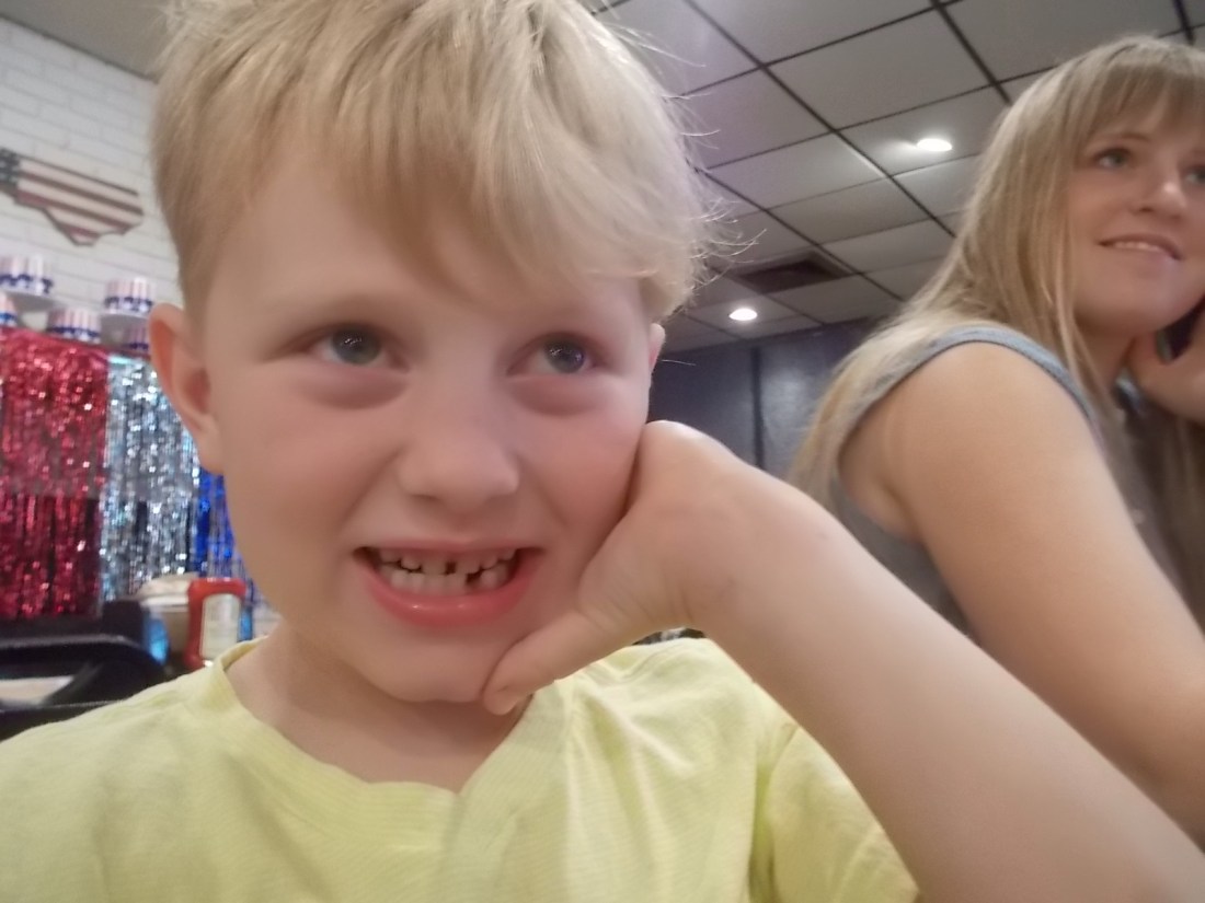 052716 Tooth pulled the night before.JPG